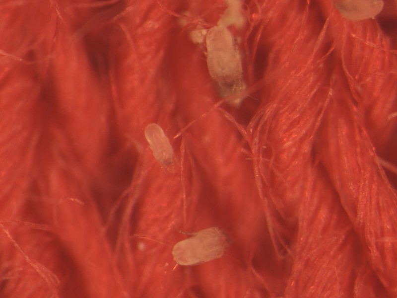 Anti-dust mite textiles may help relieve neurodermatitis symptoms